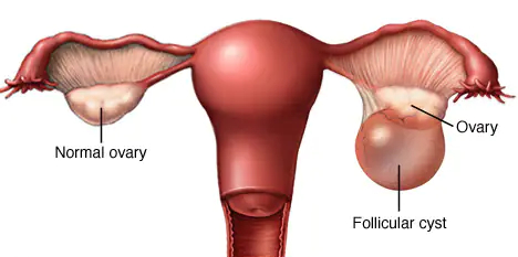 gynae in south delhi